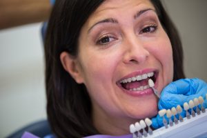 dental crown front tooth