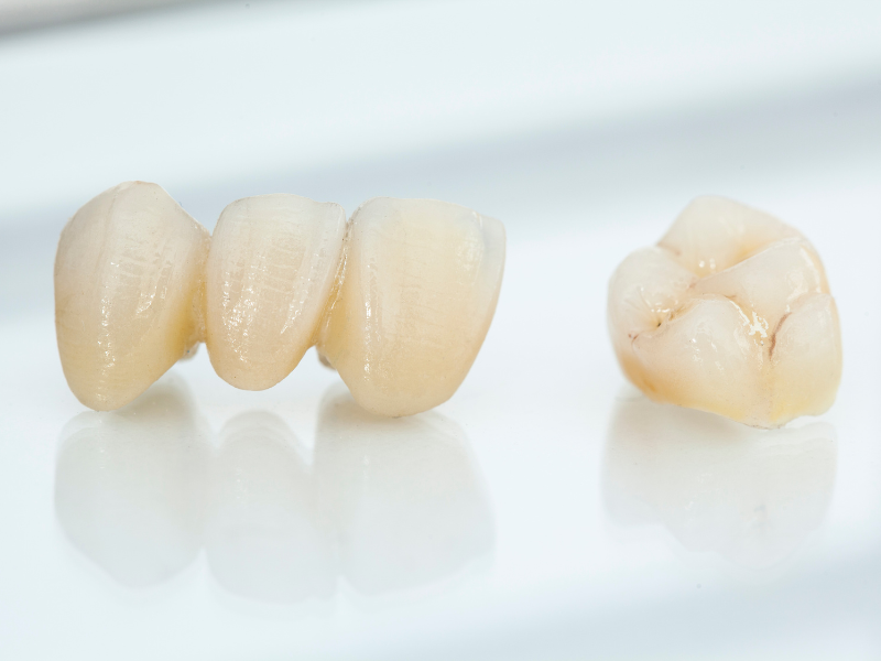 How Long Do Dental Crowns Last