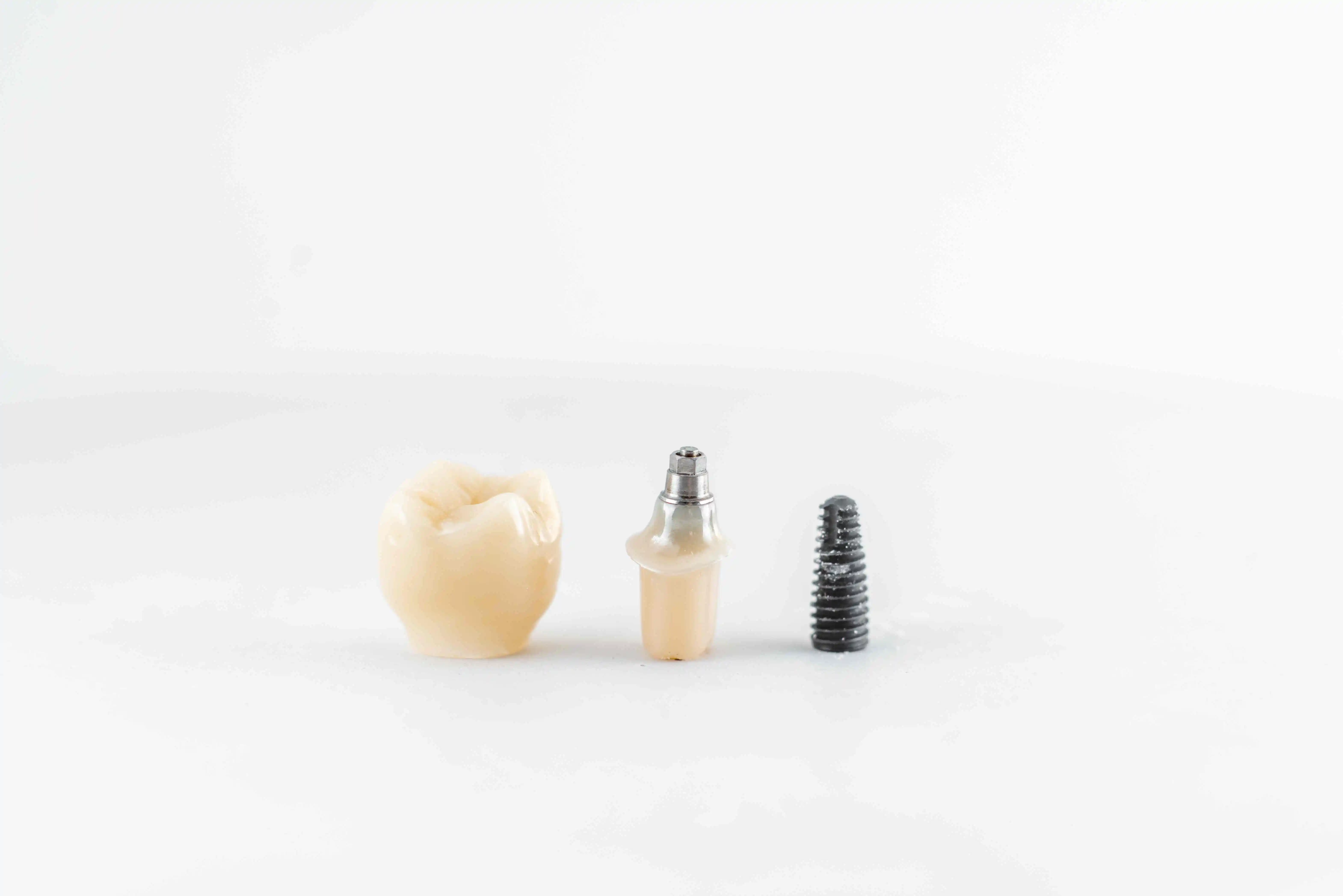 What are Dental Implants Made of