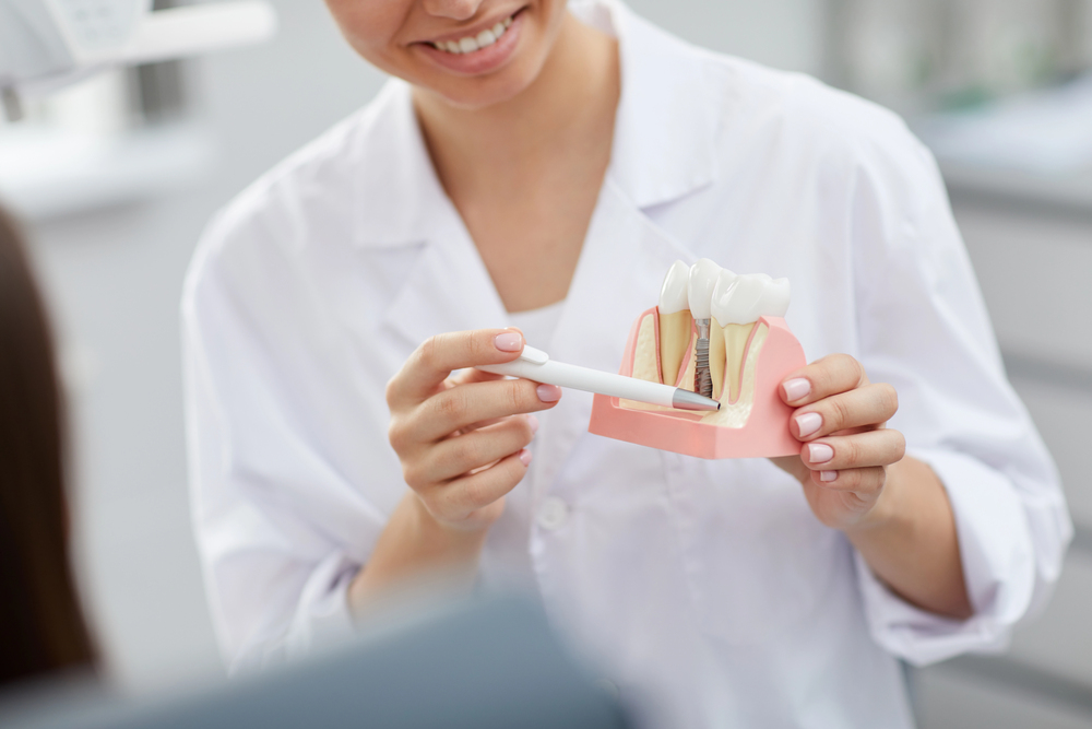 Dental Implants Hopkins