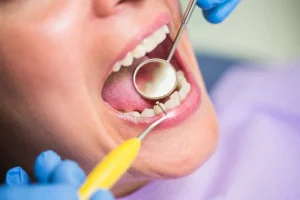 chipped tooth crown​