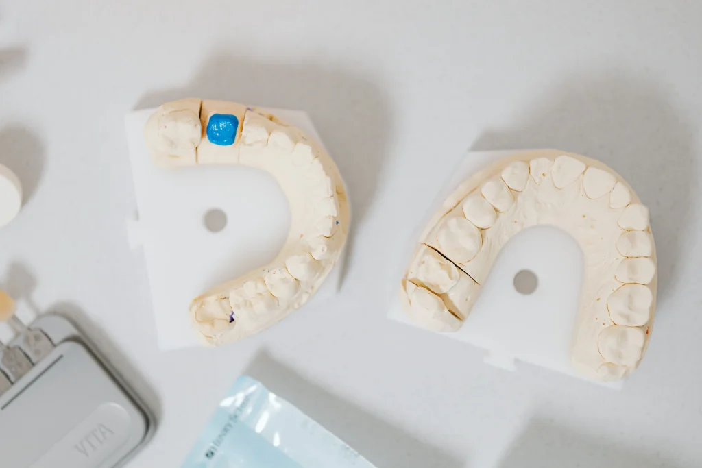 types of dental crowns